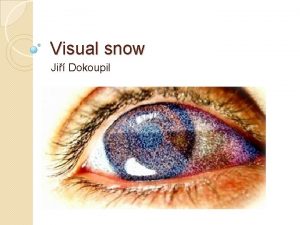 Visual snow Ji Dokoupil Visual snow Permanentn percepce