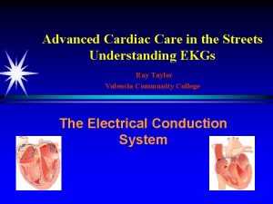 Advanced Cardiac Care in the Streets Understanding EKGs