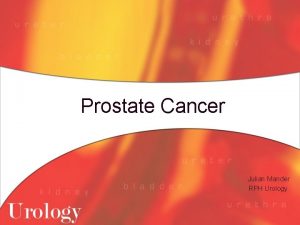 Prostate Cancer Julian Mander RPH Urology Histological Incidence