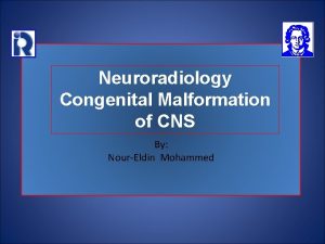 Neuroradiology Congenital Malformation of CNS By NourEldin Mohammed