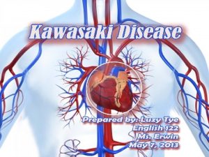 What is Kawasaki Disease Kawasaki Disease KD also