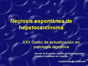 Necrosis espontnea de hepatocarcinoma XXV Curso de actualizacin