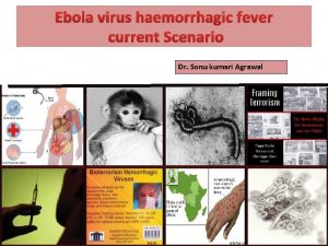 Ebola virus haemorrhagic fever current Scenario Dr Sonu