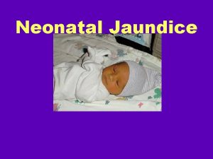 Neonatal Jaundice Neonatal Jaundice Learning Objectives Define hyperbilirubinemia