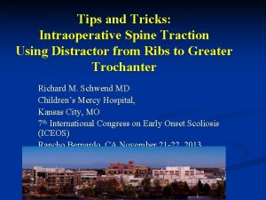 Tips and Tricks Intraoperative Spine Traction Using Distractor