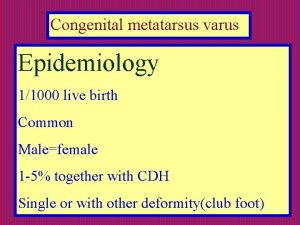 Congenital metatarsus varus Epidemiology 11000 live birth Common