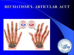 REUMATISMUL ARTICULAR ACUT Reumatismul articular acut RAA este