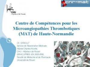 Centre de Comptences pour les Microangiopathies Thrombotiques MAT