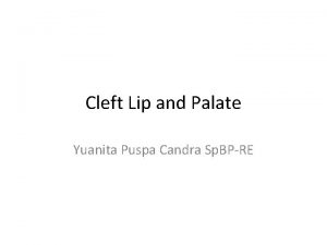 Cleft Lip and Palate Yuanita Puspa Candra Sp