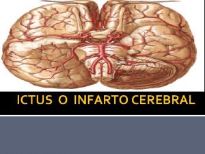 ICTUS O INFARTO CEREBRAL DEFINICION El infarto cerebral