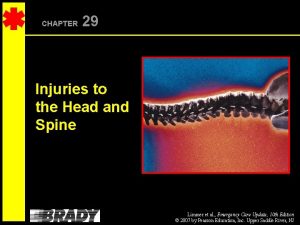 CHAPTER 29 Injuries to the Head and Spine