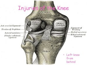 Injuries of the Knee Left knee from behind