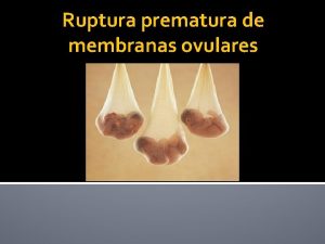 Ruptura prematura de membranas ovulares Definio Rotura prematura