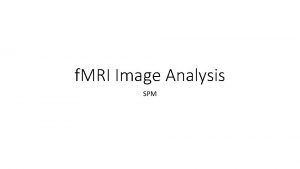 f MRI Image Analysis SPM f MRI Processing