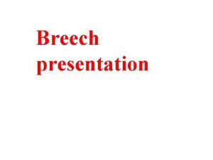 Breech presentation Breech presentation or podalic when buttock