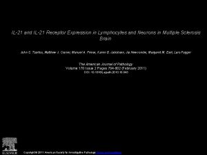 IL21 and IL21 Receptor Expression in Lymphocytes and