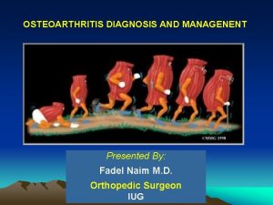 OSTEOARTHRITIS DIAGNOSIS AND MANAGENENT Presented By Fadel Naim