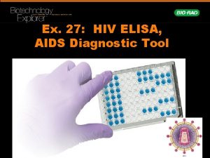 Ex 27 HIV ELISA AIDS Diagnostic Tool Human