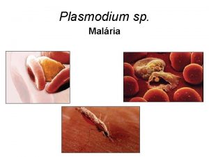 Plasmodium sp Malria Malria ou Paludismo Doena tropical