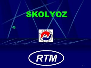 SKOLYOZ RTM 1 Salkl bir vertebral kolonda vertebralar