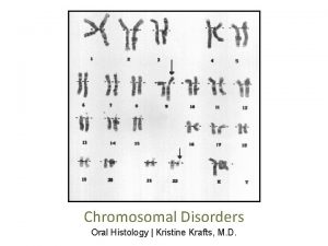 Chromosomal Disorders Oral Histology Kristine Krafts M D