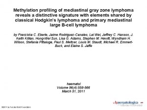 Methylation profiling of mediastinal gray zone lymphoma reveals