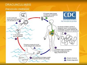 DRACUNCULIASIS Dracunculus medinensis n n n n Los