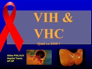 VIH VHC Quid en 2008 Gilles PIALOUX Hpital