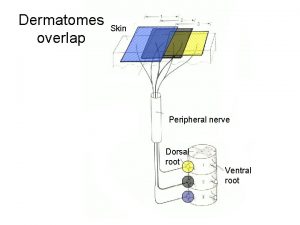 Dermatomes overlap Skin Peripheral nerve Dorsal root Ventral