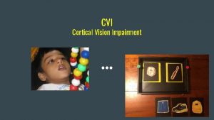 CVI Cortical Vision Impairment What is CVI Cortical