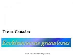 Tissue Cestodes Ecchinococcus granulosus Raed Z Ahmed Medical