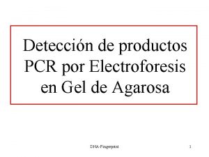 Deteccin de productos PCR por Electroforesis en Gel