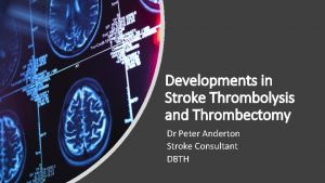 Developments in Stroke Thrombolysis and Thrombectomy Dr Peter