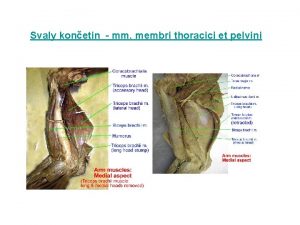 Svaly konetin mm membri thoracici et pelvini Svaly