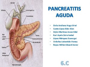 PANCREATITIS AGUDA vila Arellano Hugo Uriel Cuate Lpez