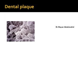 Dental plaque Dr Rayan Abdelwahid Definition Dental plague