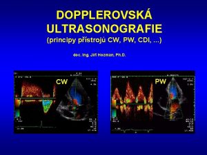 DOPPLEROVSK ULTRASONOGRAFIE principy pstroj CW PW CDI doc
