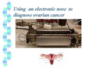 Using an electronic nose to diagnose ovarian cancer