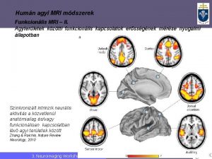 Humn agyi MRI mdszerek Funkcionlis MRI II Agyterletek
