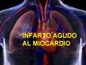 INFARTO AGUDO AL MIOCARDIO La sangre llega a