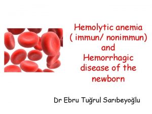 Hemolytic anemia immun nonimmun and Hemorrhagic disease of