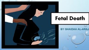 Fetal Death BY GHAIDAA ALARAJ DEFINITION Fetal death