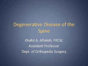 Degenerative Disease of the Spine Khalid A Al