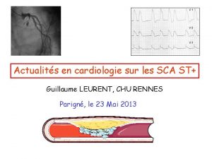 Actualits en cardiologie sur les SCA ST Guillaume