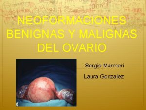 NEOFORMACIONES BENIGNAS Y MALIGNAS DEL OVARIO Sergio Marmori