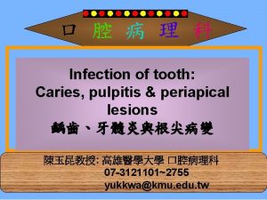 Infection of tooth Caries pulpitis periapical lesions 07
