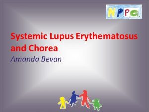 Systemic Lupus Erythematosus and Chorea Amanda Bevan Systemic