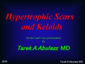 Hypertrophic Scars and Keloids Review and Case presentation