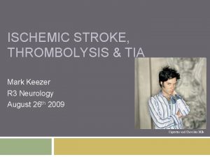 ISCHEMIC STROKE THROMBOLYSIS TIA Mark Keezer R 3