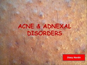 ACNE ADNEXAL DISORDERS Diany Nurdin DISORDER OF ADNEXAL